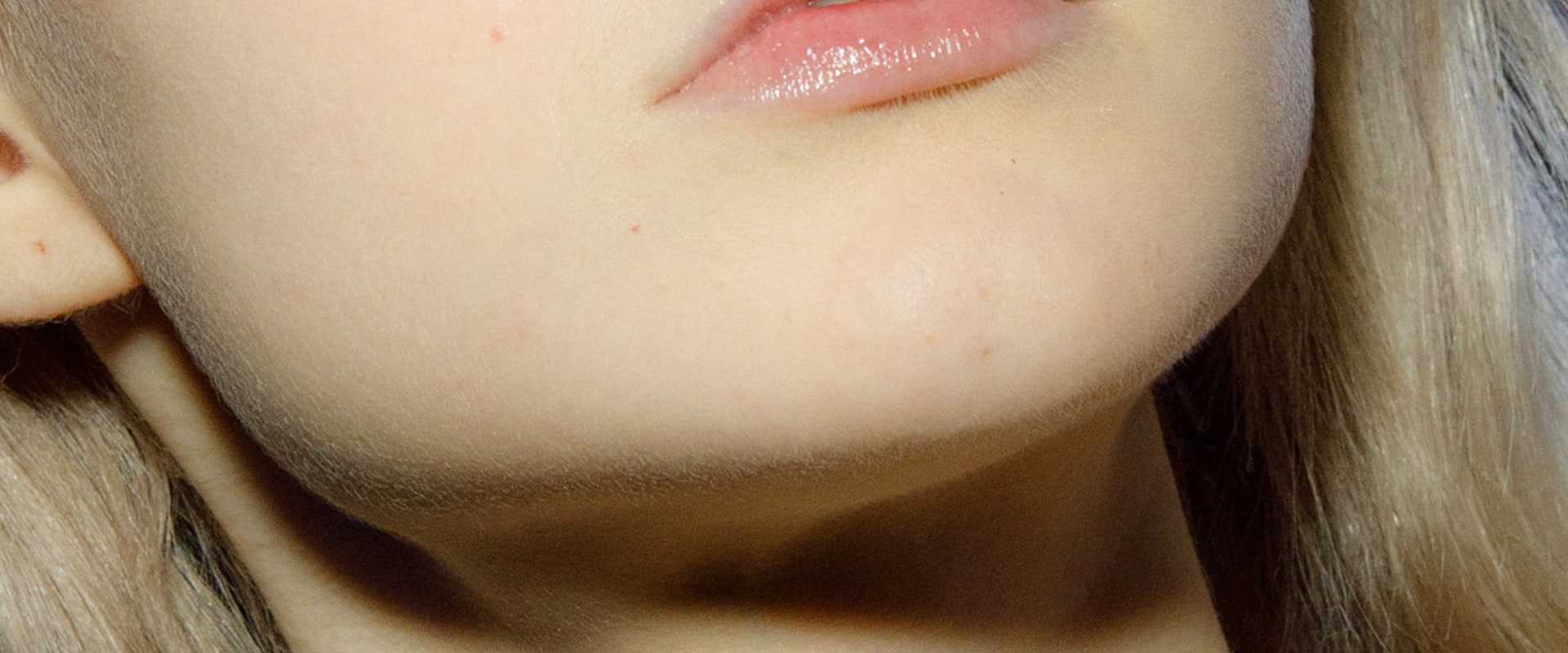 Everything You Need to Know About Inflamed Lip Fillers