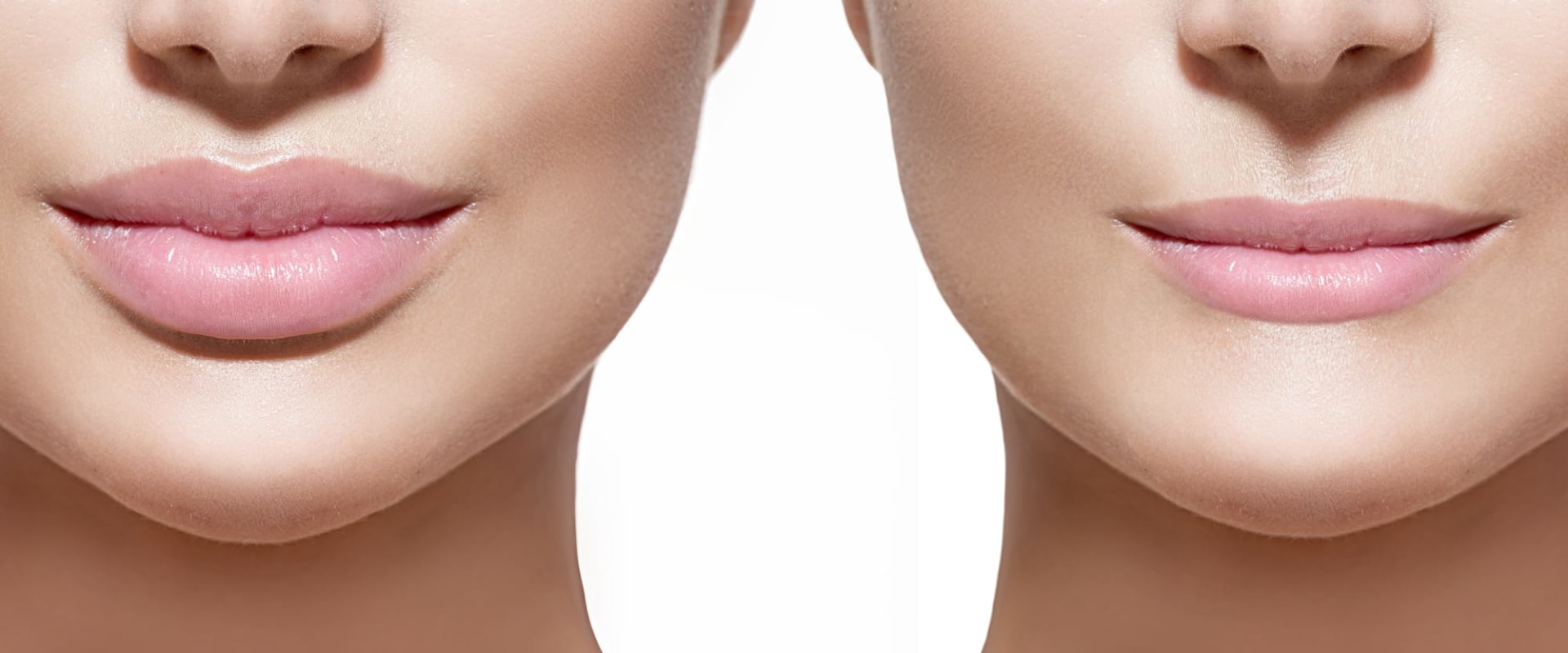 How Long Does it Take for Fillers to Look Their Best?