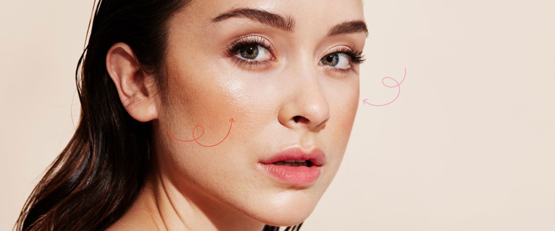 Does Cheek Filler Settle In? A Comprehensive Guide